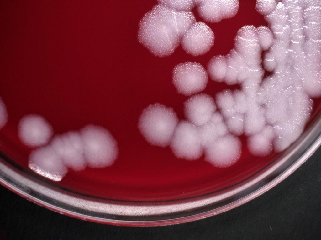 Agents, Diseases and Threats